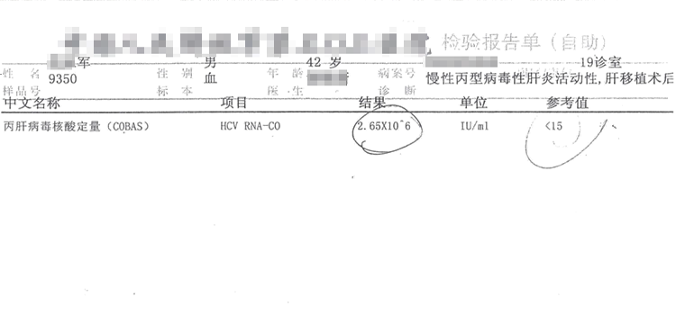 男，42岁，1b，病毒量：2.65x10^6IU/ML,肝肾移植合并感染丙肝，13天达到TND高精阴