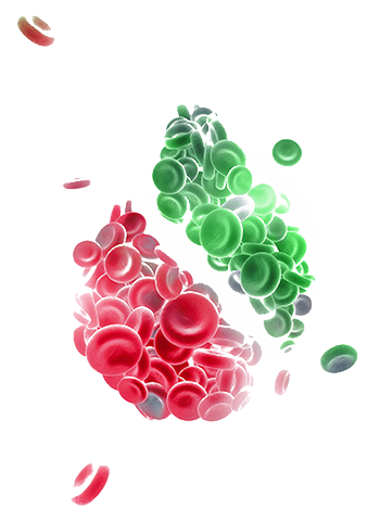 Non Hodgkin lymphoma